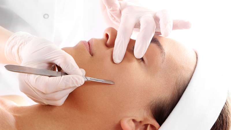 dermaplaning